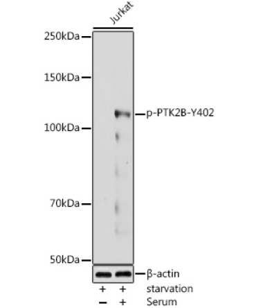 Phospho-PTK2B-Y402 Rabbit Polyclonal Antibody