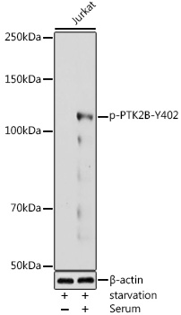 Phospho-PTK2B-Y402 Rabbit Polyclonal Antibody