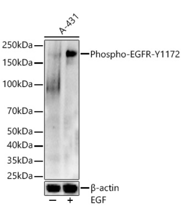 Phospho-EGFR-Y1172 Rabbit Polyclonal Antibody