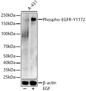 Phospho-EGFR-Y1172 Rabbit Polyclonal Antibody