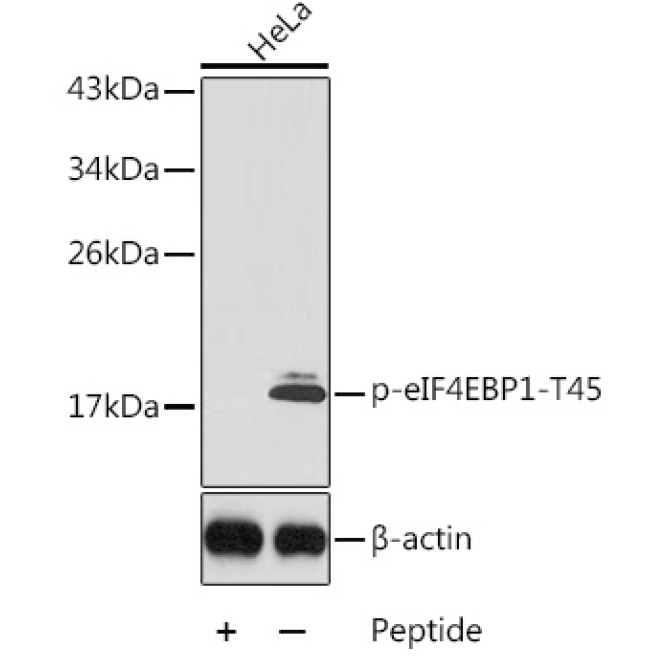 Phospho-eIF4EBP1-T45 Rabbit Polyclonal Antibody