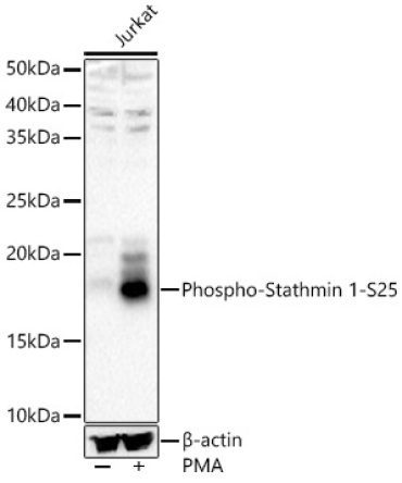 Phospho-Stathmin 1-S25 Rabbit Polyclonal Antibody