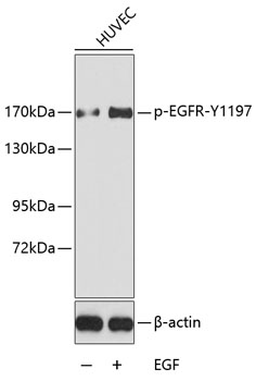 Phospho-EGFR-Y1197 Rabbit Polyclonal Antibody