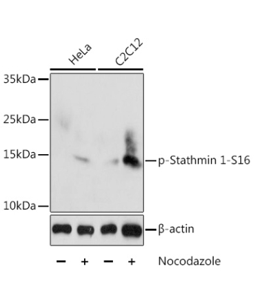 Phospho-Stathmin 1-S16 Rabbit Polyclonal Antibody