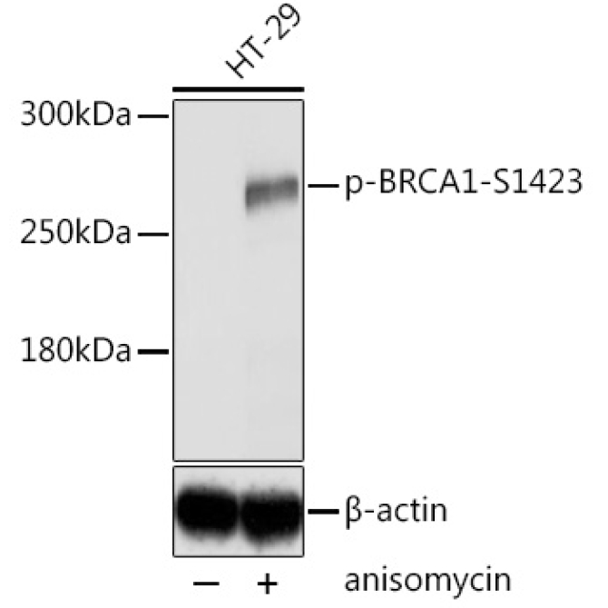 Phospho-BRCA1-S1423 Rabbit Polyclonal Antibody