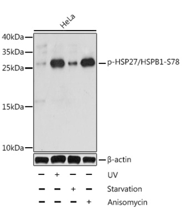 Phospho-HSP27/HSPB1-S78 Rabbit Polyclonal Antibody