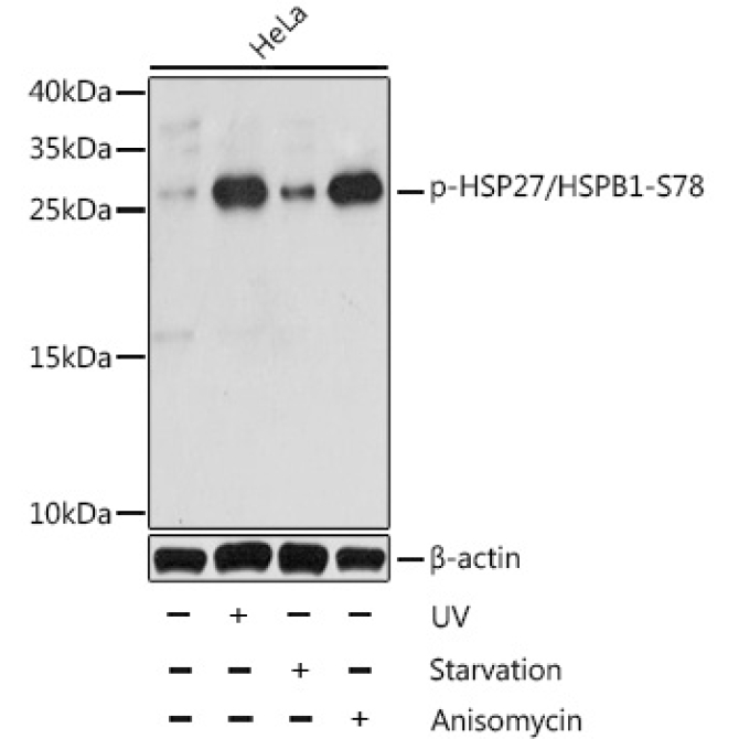 Phospho-HSP27/HSPB1-S78 Rabbit Polyclonal Antibody