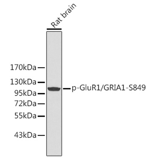 Phospho-GluR1/GRIA1-S849 Rabbit Polyclonal Antibody