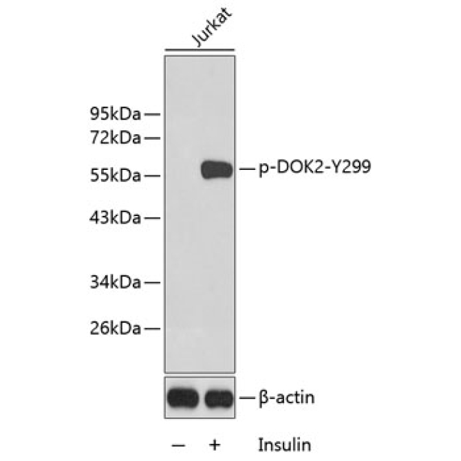 Phospho-DOK2-Y299 Rabbit Polyclonal Antibody