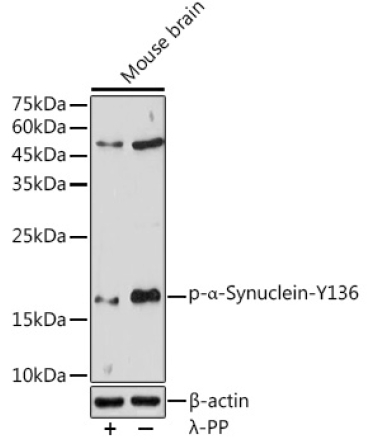 Phospho-Alpha-Synuclein-Y136 Rabbit Polyclonal Antibody