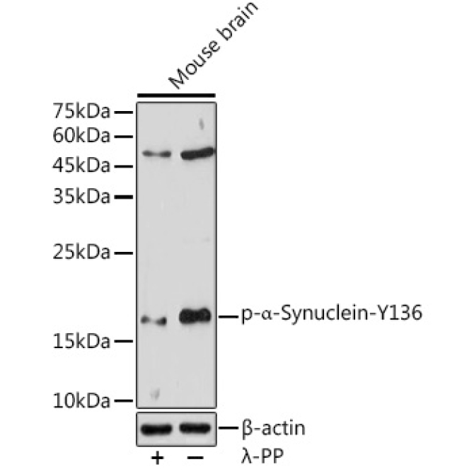 Phospho-Alpha-Synuclein-Y136 Rabbit Polyclonal Antibody
