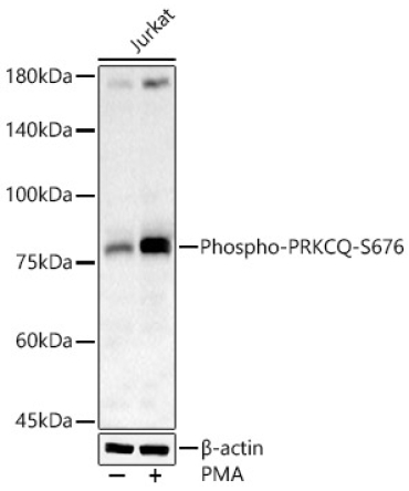 Phospho-PRKCQ-S676 Rabbit Polyclonal Antibody
