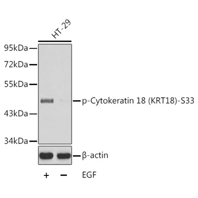 Phospho-Cytokeratin 18 (KRT18)-S33 Rabbit Polyclonal Antibody