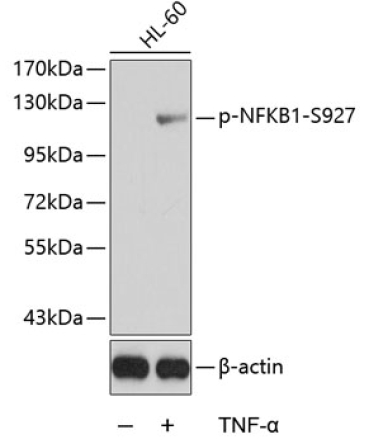 Phospho-NFKB1-S927 Rabbit Polyclonal Antibody