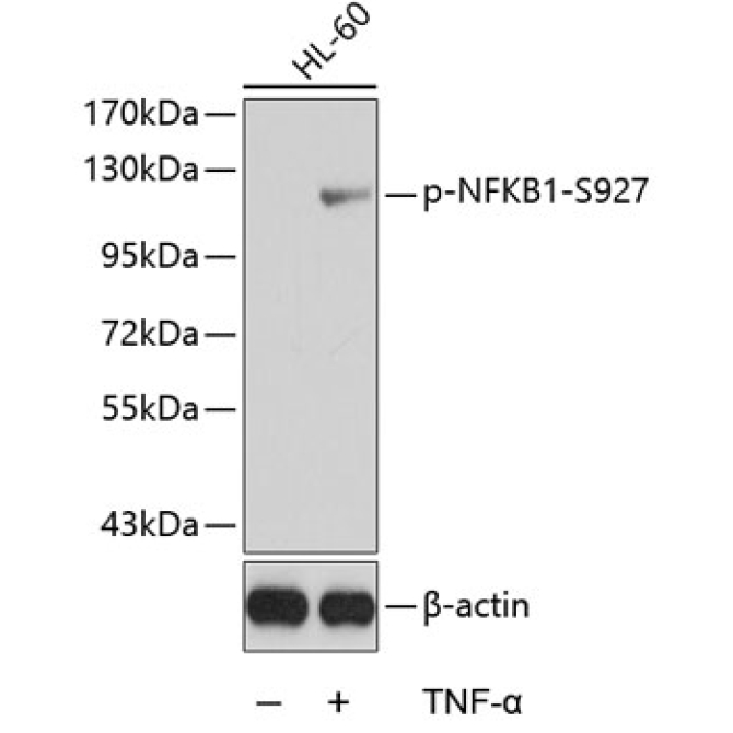 Phospho-NFKB1-S927 Rabbit Polyclonal Antibody