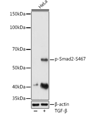 Phospho-Smad2-S467 Rabbit Polyclonal Antibody