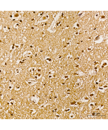 Phospho-Akt-Y315 Rabbit Polyclonal Antibody