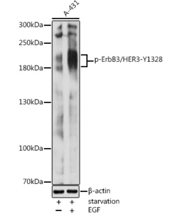 Phospho-ErbB3/HER3-Y1328 Rabbit Polyclonal Antibody