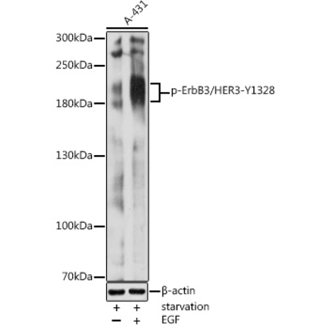 Phospho-ErbB3/HER3-Y1328 Rabbit Polyclonal Antibody