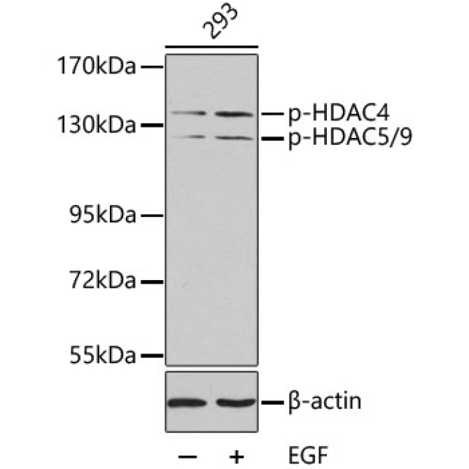 Phospho-HDAC4-S246/HDAC5-S259/HDAC9-S220 Rabbit Polyclonal Antibody