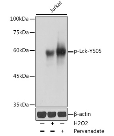 Phospho-Lck-Y505 Rabbit Polyclonal Antibody
