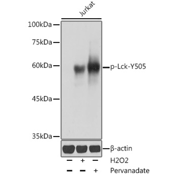 Phospho-Lck-Y505 Rabbit Polyclonal Antibody