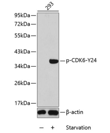 Phospho-CDK6-Y24 Rabbit Polyclonal Antibody