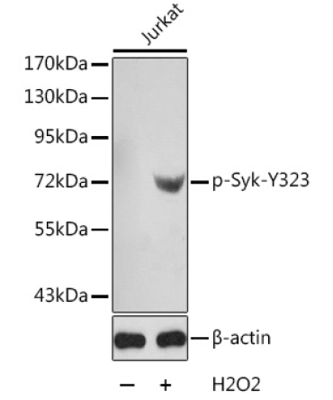 Phospho-Syk-Y323 Rabbit Polyclonal Antibody