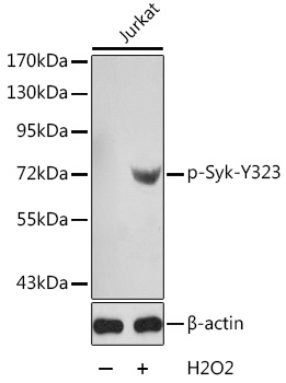 Phospho-Syk-Y323 Rabbit Polyclonal Antibody