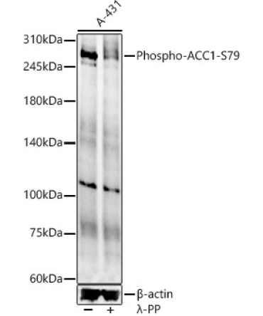 Phospho-ACC1-S79 Rabbit Polyclonal Antibody