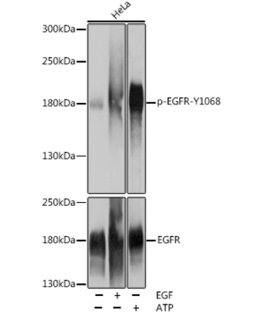 Phospho-EGFR-Y1068 Rabbit Polyclonal Antibody