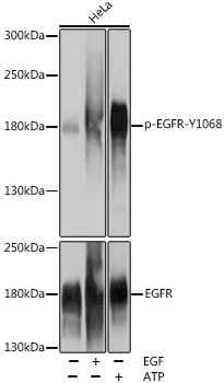 Phospho-EGFR-Y1068 Rabbit Polyclonal Antibody