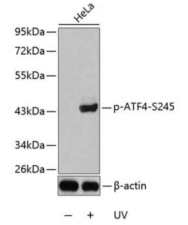 Phospho-ATF4-S245 Rabbit Polyclonal Antibody