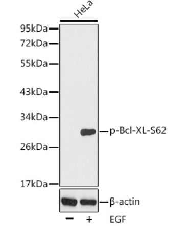 Phospho-Bcl-XL-S62 Rabbit Polyclonal Antibody