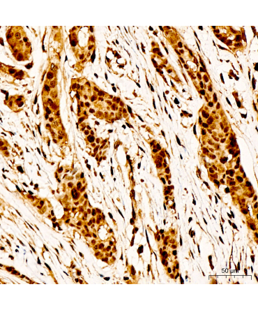 Phospho-BRCA1-S988 Rabbit Polyclonal Antibody
