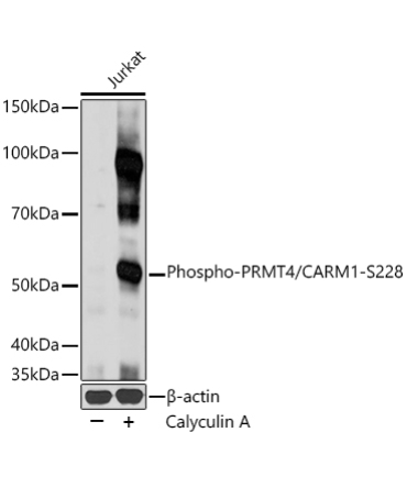 Phospho-PRMT4/CARM1-S228 Rabbit Polyclonal Antibody