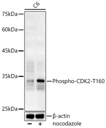 Phospho-CDK2-T160 Rabbit Polyclonal Antibody