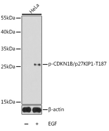 Phospho-CDKN1B/p27KIP1-T187 Rabbit Polyclonal Antibody