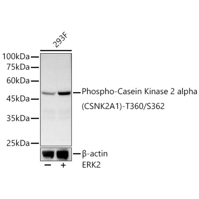 Phospho-Casein Kinase 2 alpha (CSNK2A1)-T360/S362 Rabbit Polyclonal Antibody