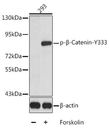 Phospho-Beta-Catenin-Y333 Rabbit Polyclonal Antibody