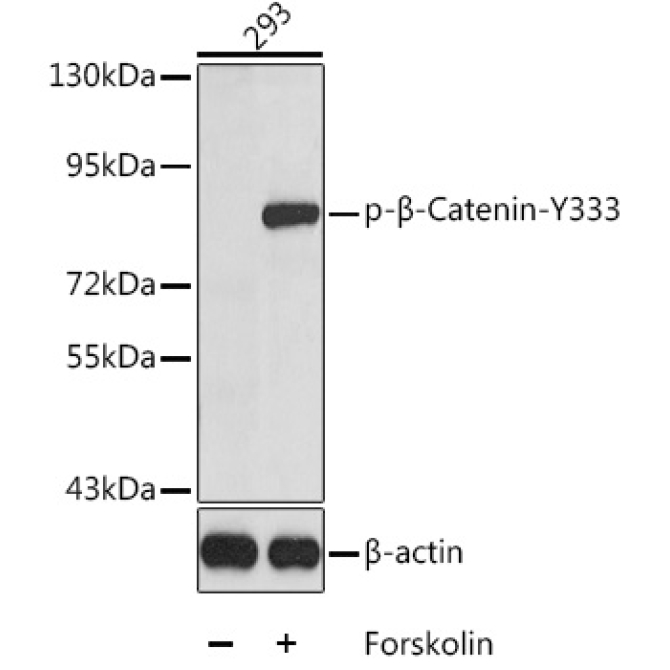 Phospho-Beta-Catenin-Y333 Rabbit Polyclonal Antibody