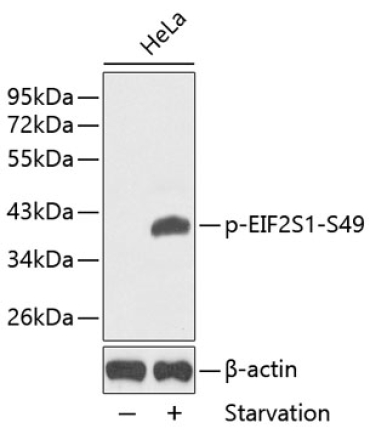 Phospho-eIF2Alpha-S49 Rabbit Polyclonal Antibody