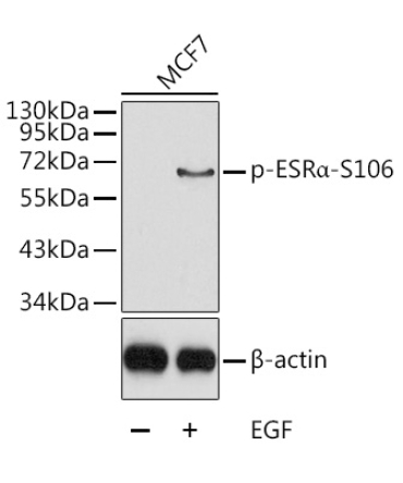 Phospho-ESRAlpha-S106 Rabbit Polyclonal Antibody