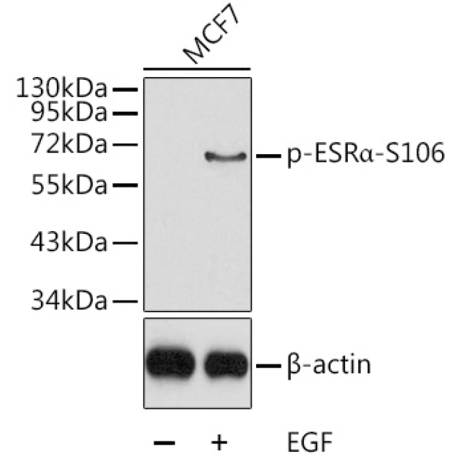 Phospho-ESRAlpha-S106 Rabbit Polyclonal Antibody