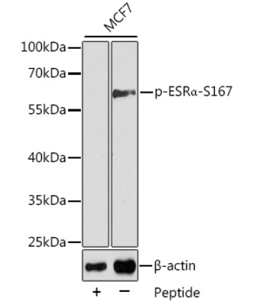 Phospho-ESRAlpha-S167 Rabbit Polyclonal Antibody