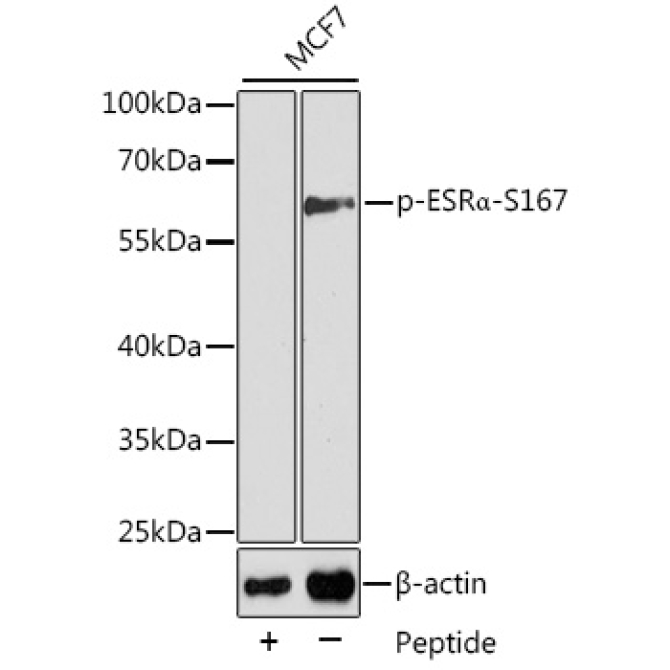Phospho-ESRAlpha-S167 Rabbit Polyclonal Antibody