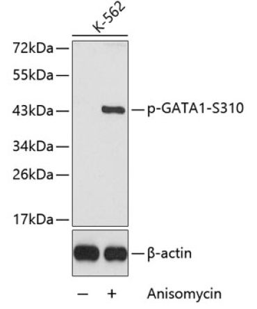 Phospho-GATA1-S310 Rabbit Polyclonal Antibody