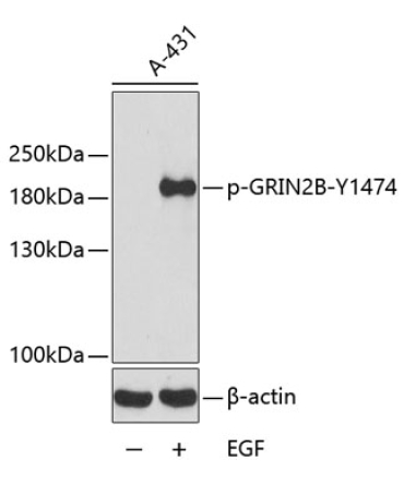 Phospho-GRIN2B-Y1474 Rabbit Polyclonal Antibody