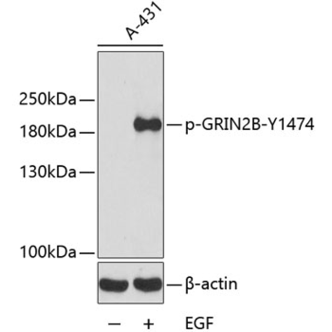 Phospho-GRIN2B-Y1474 Rabbit Polyclonal Antibody
