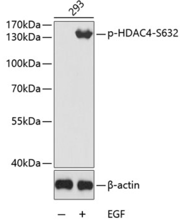 Phospho-HDAC4-S632 Rabbit Polyclonal Antibody